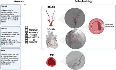 Genetics of spontaneous cervical and coronary artery dissections